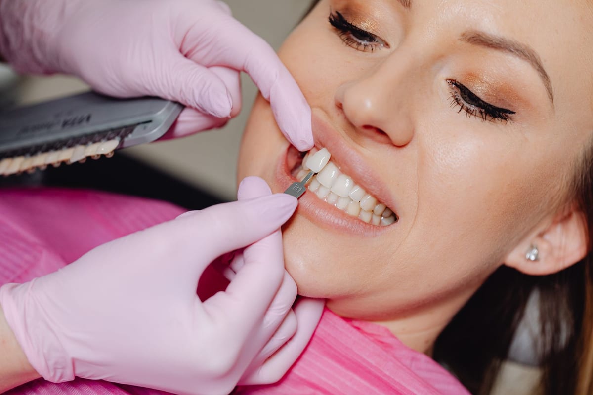 A cosmetic smile check